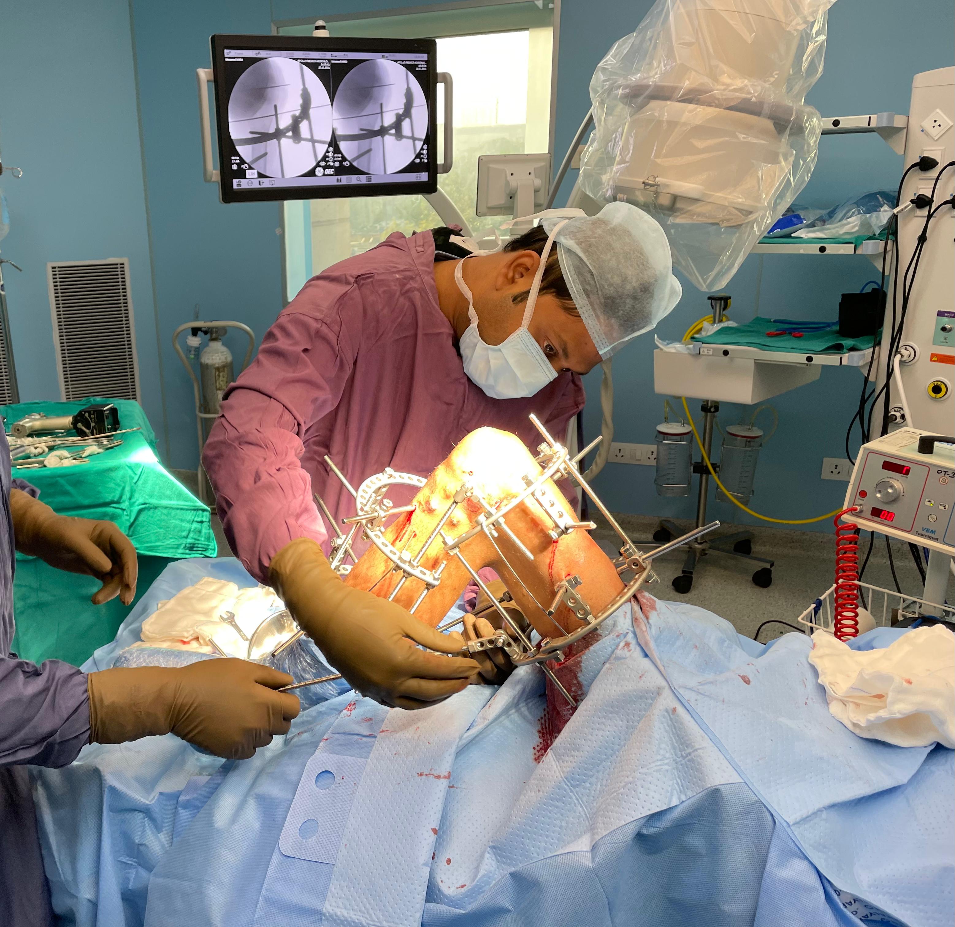 Operation